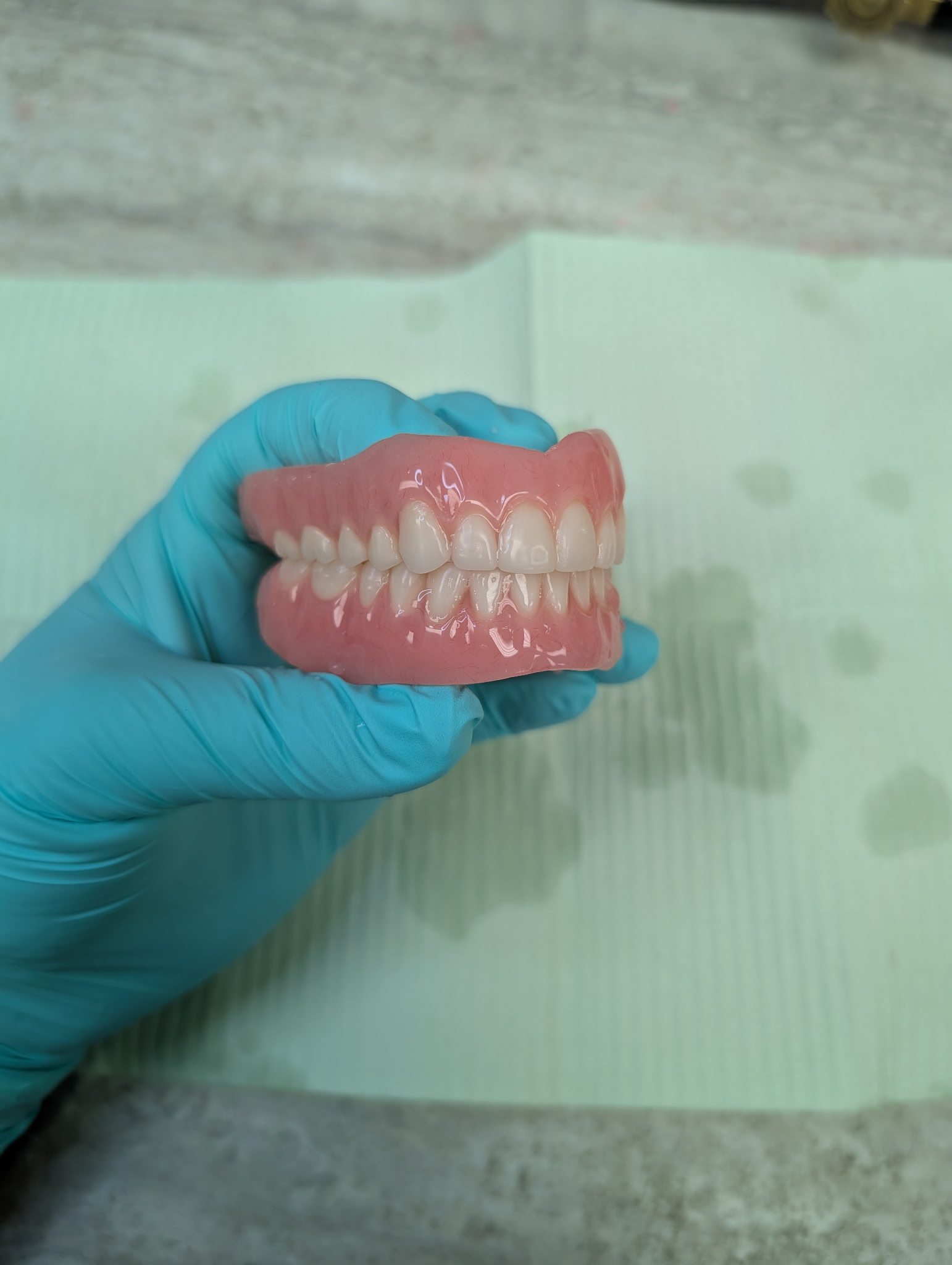Denture appliance made at Frayling Denture Clinic
