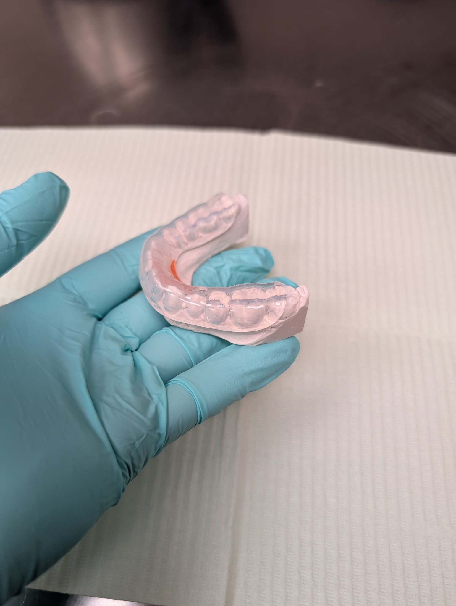 Detailed denture appliance close-up