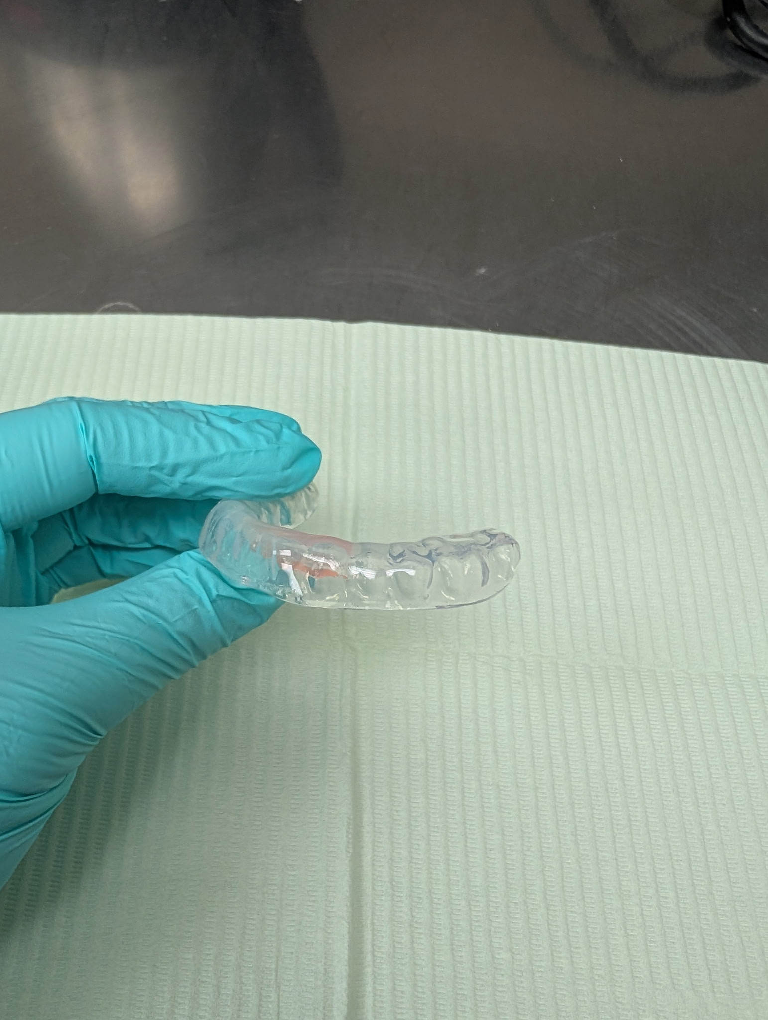 Clear dental appliance held by a gloved hand