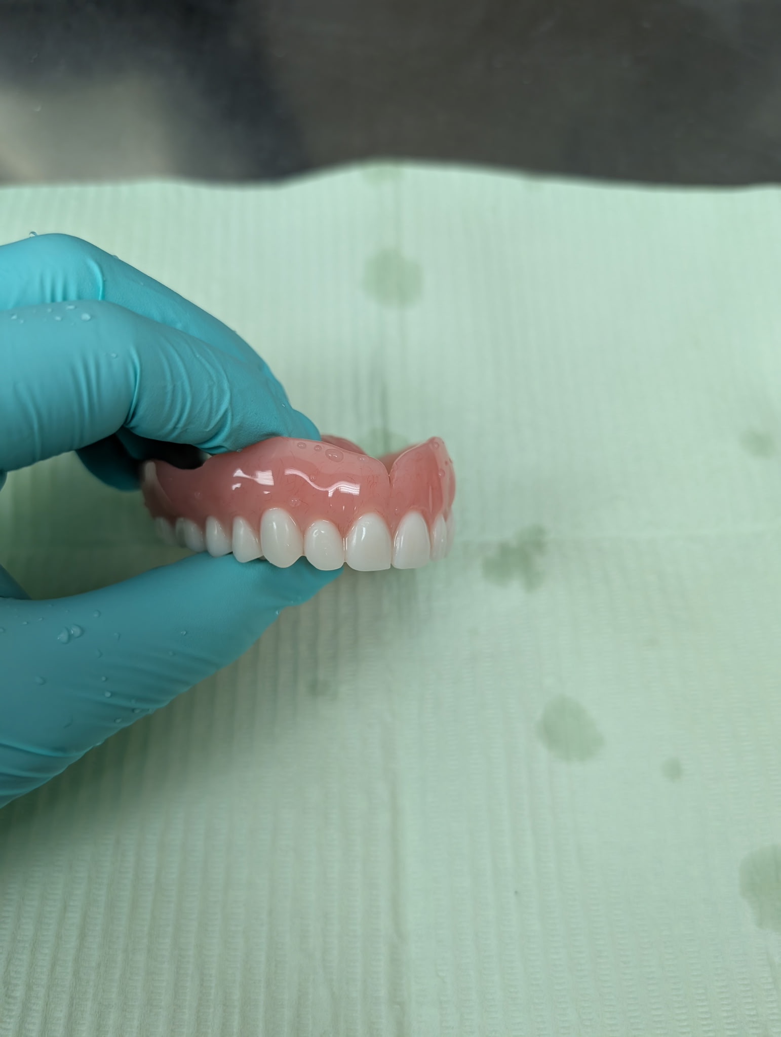Denture teeth arranged for a custom appliance